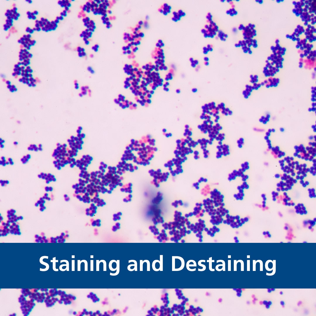Staining and Destaining Staining and Destaining